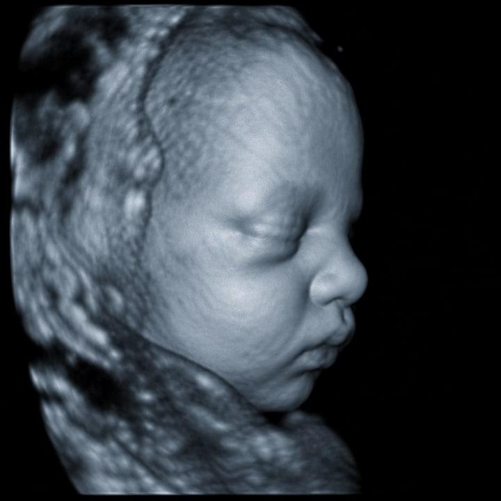 4D ultrasound still - profile