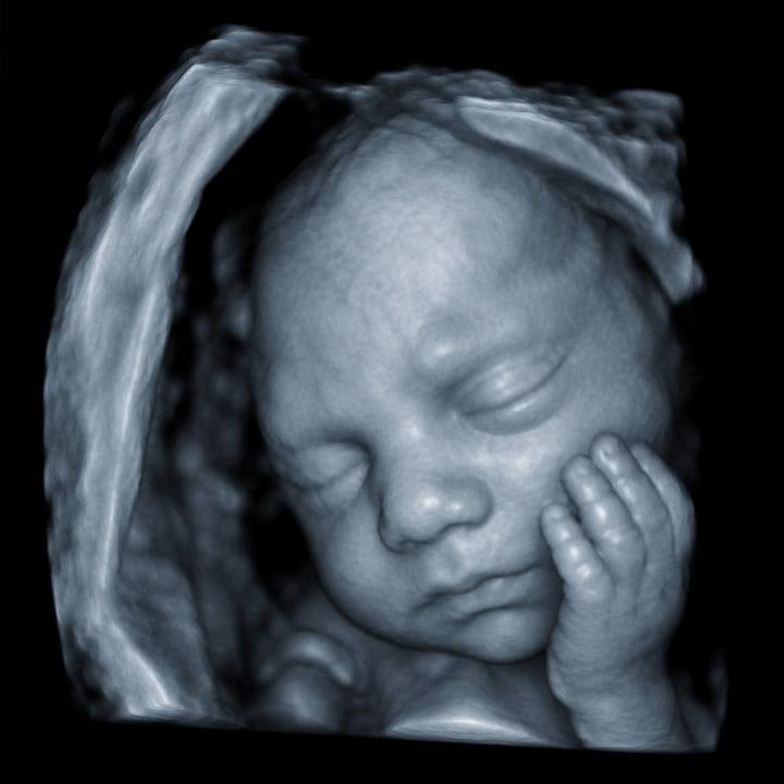 4D ultrasound still - face and hand