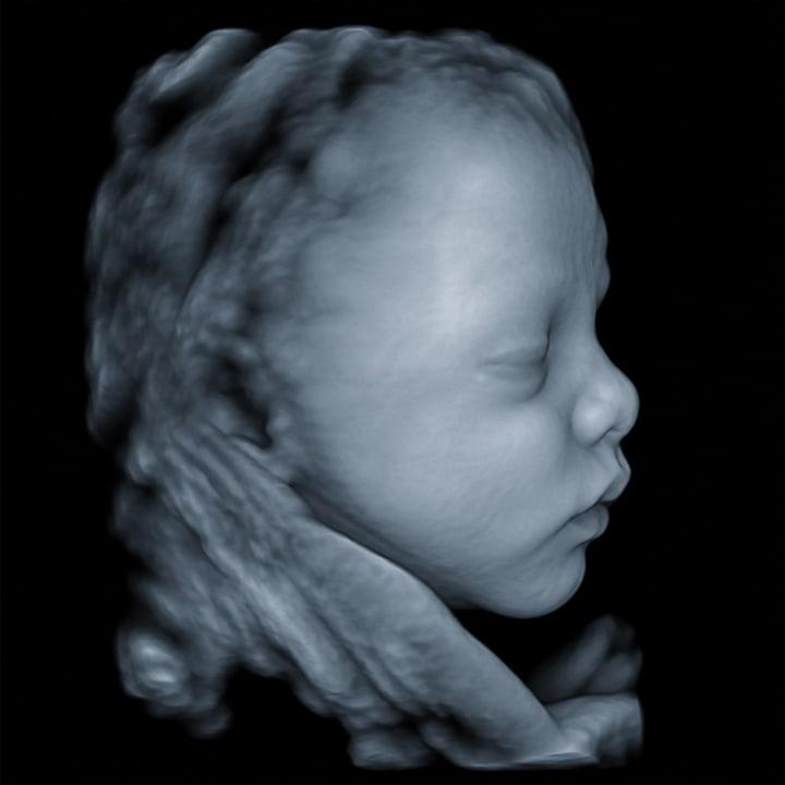 4D ultrasound still - side profile